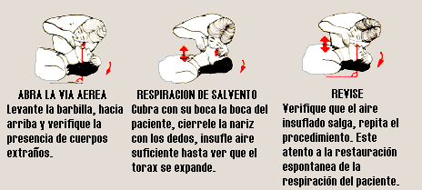 Respiración de Salvamento