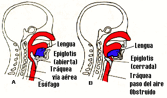 hiperextension
