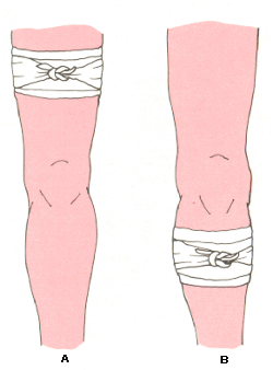 pierna